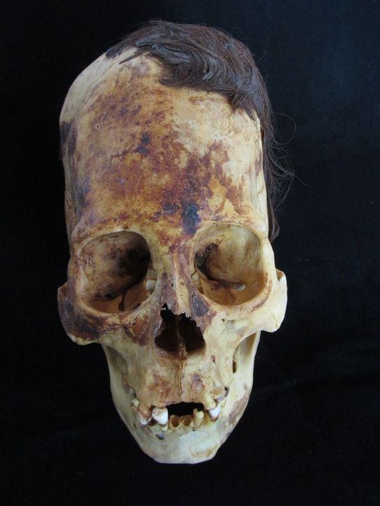 Dieser Paracas-Schädel ist einer von Hunderten von seltsamen, missgestaltete... - Bildquelle: Brien Foerster